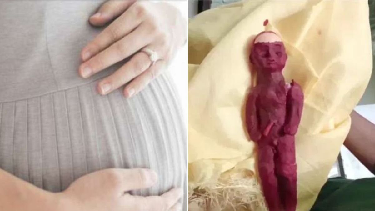 OMG! शादी के 18 साल बाद महिला ने दिया 'प्लास्टिक की गुड़िया' को जन्म